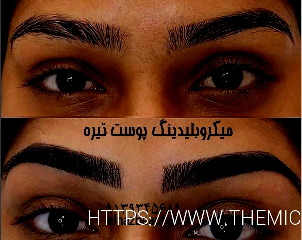 بهترین کاشت ناخن اصفهان